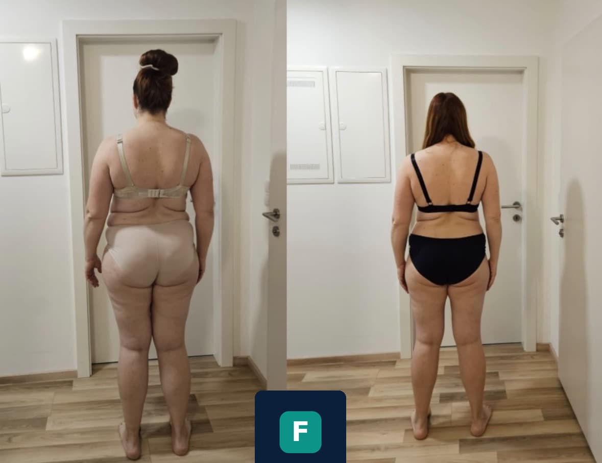 Before and after fitness transformation (back view)